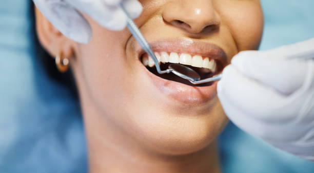 Best Holiday Emergency Dentist in Wake Forest, NC