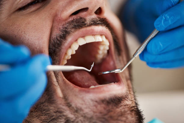 Best Emergency Dental Services for Seniors in Wake Forest, NC